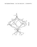 VASCULAR REMODELING DEVICE diagram and image