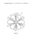 VASCULAR REMODELING DEVICE diagram and image