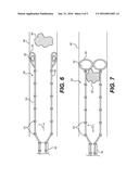 MEDICAL RETRIEVAL DEVICES AND METHODS diagram and image