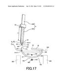 MEDICAL DEVICE diagram and image