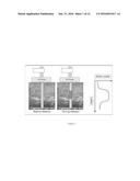 REAL TIME THREE-DIMENSIONAL HEAT-INDUCED ECHO-STRAIN IMAGING FOR     MONITORING HIGH-INTENSITY ACOUSTIC ABLATION PRODUCED BY CONFORMAL     INTERSTITIAL AND EXTERNAL DIRECTIONAL ULTRASOUND THERAPY APPLICATORS diagram and image