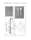 REAL TIME THREE-DIMENSIONAL HEAT-INDUCED ECHO-STRAIN IMAGING FOR     MONITORING HIGH-INTENSITY ACOUSTIC ABLATION PRODUCED BY CONFORMAL     INTERSTITIAL AND EXTERNAL DIRECTIONAL ULTRASOUND THERAPY APPLICATORS diagram and image