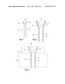 Bone Screw diagram and image