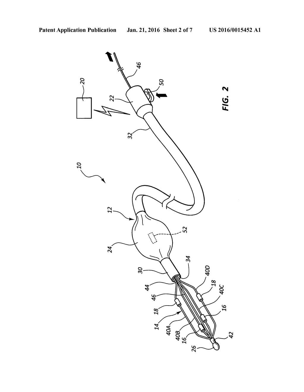 FEEDBACK SYSTEMS AND METHODS FOR RENAL DENERVATION UTILIZING BALLOON     CATHETER - diagram, schematic, and image 03