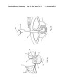 SURGICAL TISSUE RECOGNITION AND NAVIGATION APPARATUS AND METHOD diagram and image