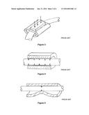 Archwire Assembly With Non-Linear Crimpable Orthodontic Stop and Method of     Manufacture diagram and image