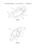 Archwire Assembly With Non-Linear Crimpable Orthodontic Stop and Method of     Manufacture diagram and image