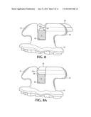 Self-ligating Bracket with Sliding Cover diagram and image