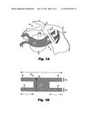 APPARATUS AND METHOD FOR REPAIRING VAGINAL RECONSTRUCTION diagram and image