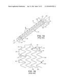 STENT HAVING ADJACENT ELEMENTS CONNECTED BY NARROW FLEXIBLE WEBS diagram and image