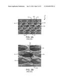 STENT HAVING ADJACENT ELEMENTS CONNECTED BY NARROW FLEXIBLE WEBS diagram and image