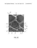 STENT HAVING ADJACENT ELEMENTS CONNECTED BY NARROW FLEXIBLE WEBS diagram and image