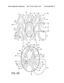 STENT HAVING ADJACENT ELEMENTS CONNECTED BY NARROW FLEXIBLE WEBS diagram and image