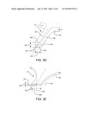 STENT HAVING ADJACENT ELEMENTS CONNECTED BY NARROW FLEXIBLE WEBS diagram and image