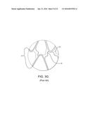 STENT HAVING ADJACENT ELEMENTS CONNECTED BY NARROW FLEXIBLE WEBS diagram and image