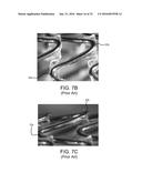 STENT HAVING ADJACENT ELEMENTS CONNECTED BY NARROW FLEXIBLE WEBS diagram and image