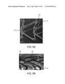 STENT HAVING ADJACENT ELEMENTS CONNECTED BY NARROW FLEXIBLE WEBS diagram and image