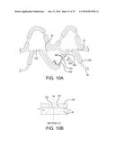 STENT HAVING ADJACENT ELEMENTS CONNECTED BY NARROW FLEXIBLE WEBS diagram and image