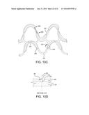 STENT HAVING ADJACENT ELEMENTS CONNECTED BY NARROW FLEXIBLE WEBS diagram and image