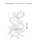 STENT HAVING ADJACENT ELEMENTS CONNECTED BY NARROW FLEXIBLE WEBS diagram and image