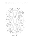 STENT HAVING ADJACENT ELEMENTS CONNECTED BY NARROW FLEXIBLE WEBS diagram and image