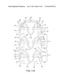 STENT HAVING ADJACENT ELEMENTS CONNECTED BY NARROW FLEXIBLE WEBS diagram and image