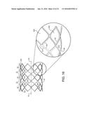 STENT HAVING ADJACENT ELEMENTS CONNECTED BY NARROW FLEXIBLE WEBS diagram and image