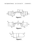 Cuspid and First Bi-Cuspid Bite Retainer for Sleep Apnea diagram and image