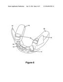 Cuspid and First Bi-Cuspid Bite Retainer for Sleep Apnea diagram and image