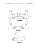 Cuspid and First Bi-Cuspid Bite Retainer for Sleep Apnea diagram and image