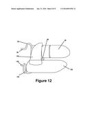 Cuspid and First Bi-Cuspid Bite Retainer for Sleep Apnea diagram and image