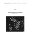 RECOMBINANT GALLID HERPESVIRUS 3 (MDV SEROTYPE 2) VECTORS EXPRESSING     ANTIGENS OF AVIAN PATHOGENS AND USES THEREOF diagram and image