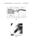 Implantation Of A Transapical Ventricular Assist Device And Kit For Same diagram and image