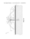 Fluid Delivery Devices, Systems and Methods diagram and image