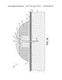 Fluid Delivery Devices, Systems and Methods diagram and image