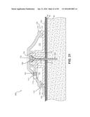 Fluid Delivery Devices, Systems and Methods diagram and image