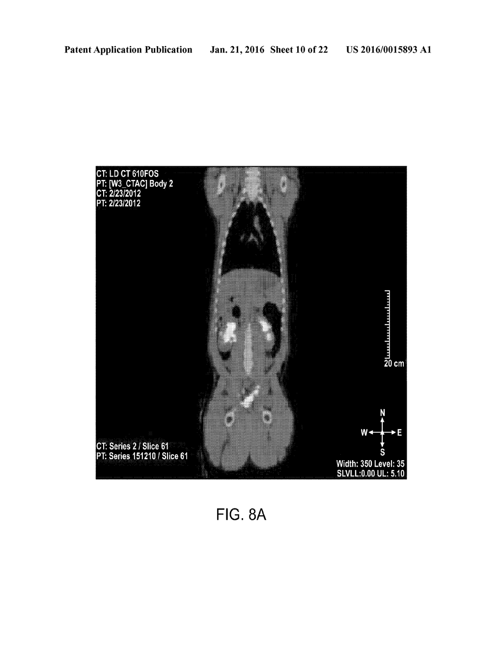 DIRECT PRESSURE-MEDIATED INTRA-BONE DELIVERY SYSTEM FOR CELLULAR     THERAPEUTICS - diagram, schematic, and image 11