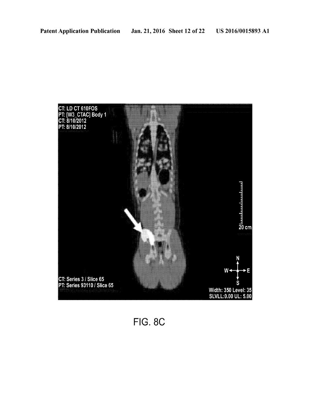 DIRECT PRESSURE-MEDIATED INTRA-BONE DELIVERY SYSTEM FOR CELLULAR     THERAPEUTICS - diagram, schematic, and image 13