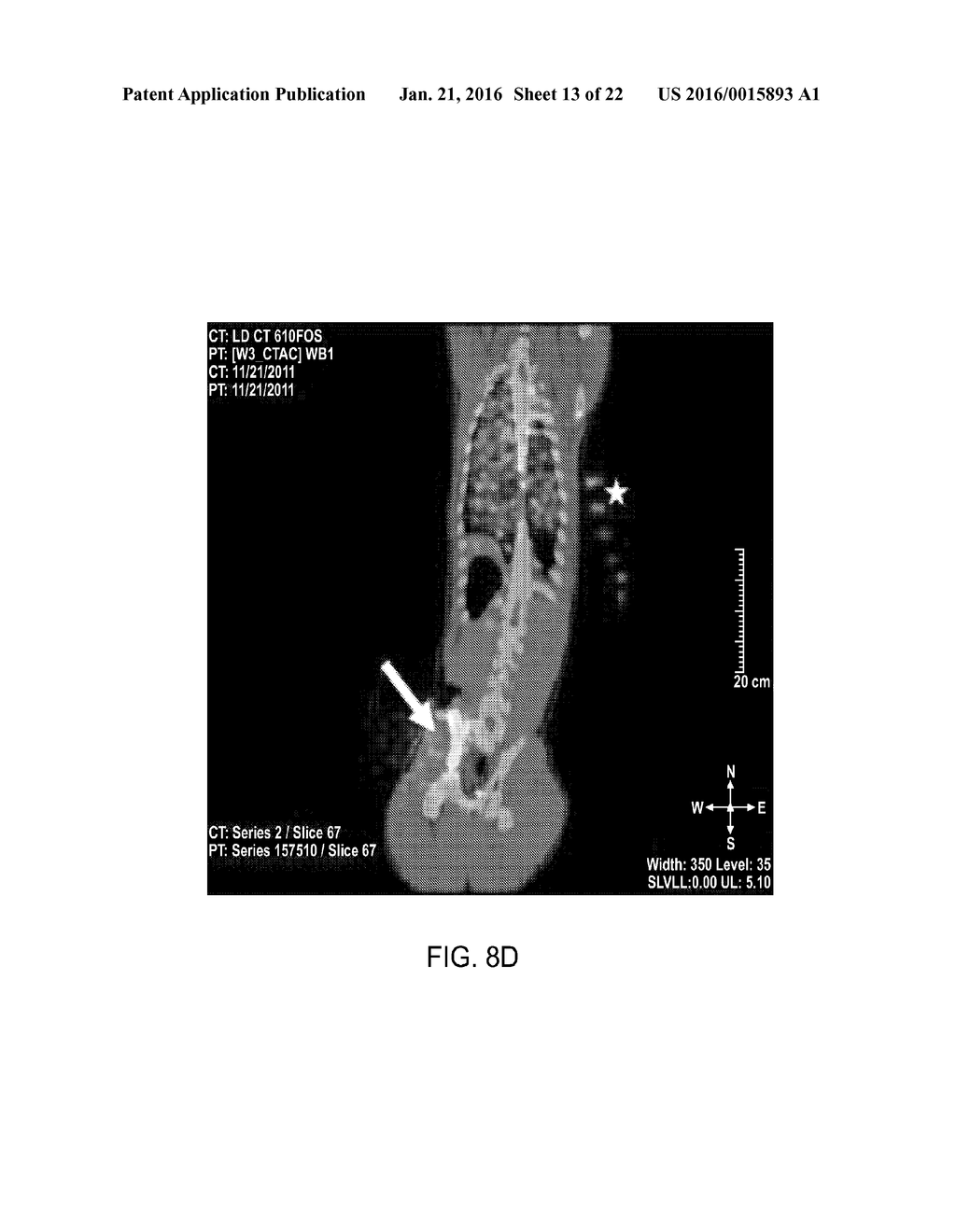 DIRECT PRESSURE-MEDIATED INTRA-BONE DELIVERY SYSTEM FOR CELLULAR     THERAPEUTICS - diagram, schematic, and image 14