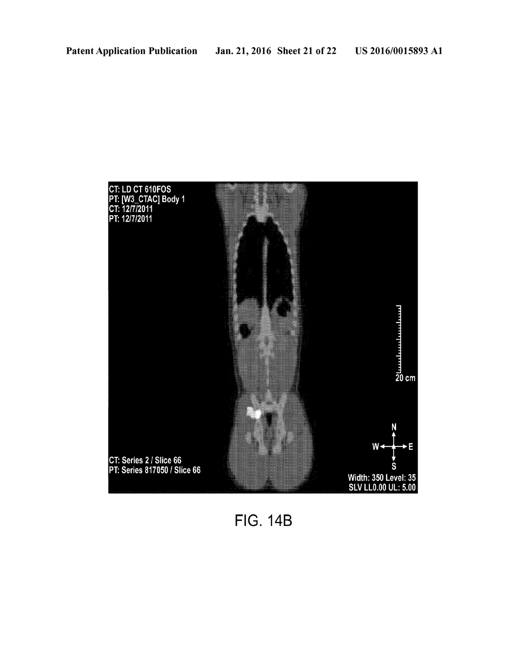 DIRECT PRESSURE-MEDIATED INTRA-BONE DELIVERY SYSTEM FOR CELLULAR     THERAPEUTICS - diagram, schematic, and image 22