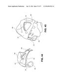 POSITIVE AIRWAY PRESSURE SYSTEMS diagram and image