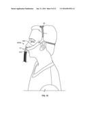 FACIAL INTERFACE AND HEADGEAR SYSTEM FOR USE WITH VENTILATION AND POSITIVE     AIR PRESSURE SYSTEMS diagram and image