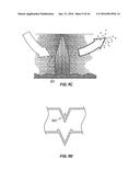 MEDICAL COMPONENTS WITH MICROSTRUCTURES FOR HUMIDIFICATION AND CONDENSATE     MANAGEMENT diagram and image