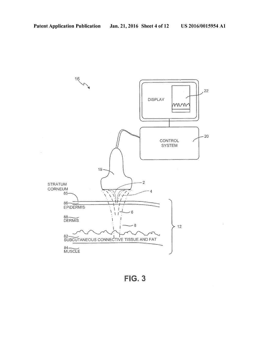 Methods and Systems for Modulating Medicants Using Acoustic Energy - diagram, schematic, and image 05