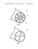 Treatment Using Low Intensity Laser Therapy diagram and image