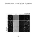 METHODS AND THERAPEUTICS COMPRISING LIGAND-TARGETED ELPs diagram and image