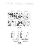 MICRORNAS AS FUNCTIONAL MEDIATORS AND BIOMARKERS OF BONE METASTASIS diagram and image