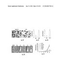 MICRORNAS AS FUNCTIONAL MEDIATORS AND BIOMARKERS OF BONE METASTASIS diagram and image