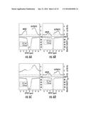 Magnetic Resonance System and Method for Detecting the Buildup of the     Transfer of Changes in Magnetization from Nuclei in Mobile Solute     Molecules in Tissue diagram and image