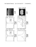 Magnetic Resonance System and Method for Detecting the Buildup of the     Transfer of Changes in Magnetization from Nuclei in Mobile Solute     Molecules in Tissue diagram and image